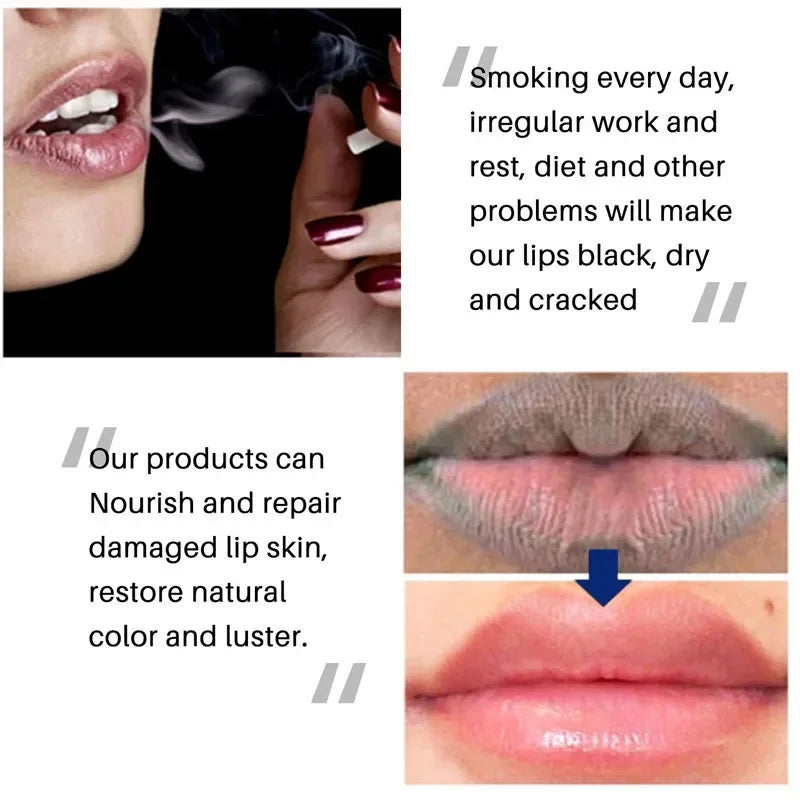 Lip Balm Remove Dark Pigment Lightening Moisturizing Cream Hyaluronic Acid Exfoliating Dead Skin Whitening Beauty Health Care