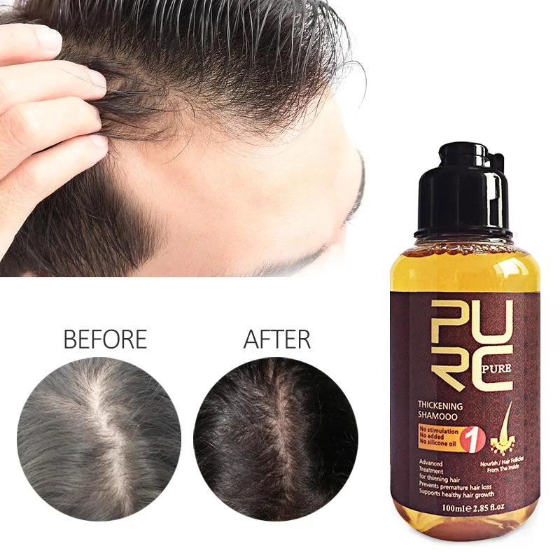 100ml Shampoo For Hair Thickening Hair Growth Shampoo and Conditioner Anti Hair Loss Scalp Cleaning Smooth Shampoos Products Set