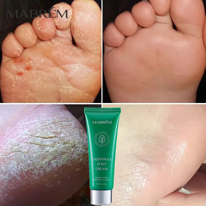 Calendula Foot Cream Pedicure Beauty Wellness Foot Peeling Mask Pedicure Repair Skin Detox Hydration Moisturizing