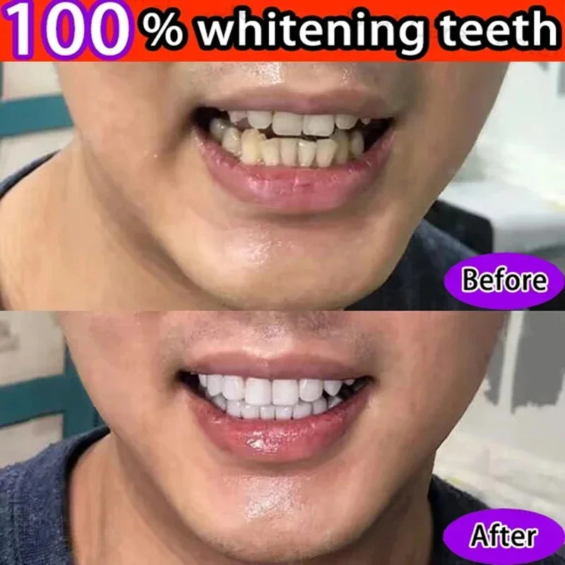 Whitening Teeth Toothpaste Dental Calculus Remover Plaque Remover Fresh Breath Brightening Preventing Periodontitis Dental Care